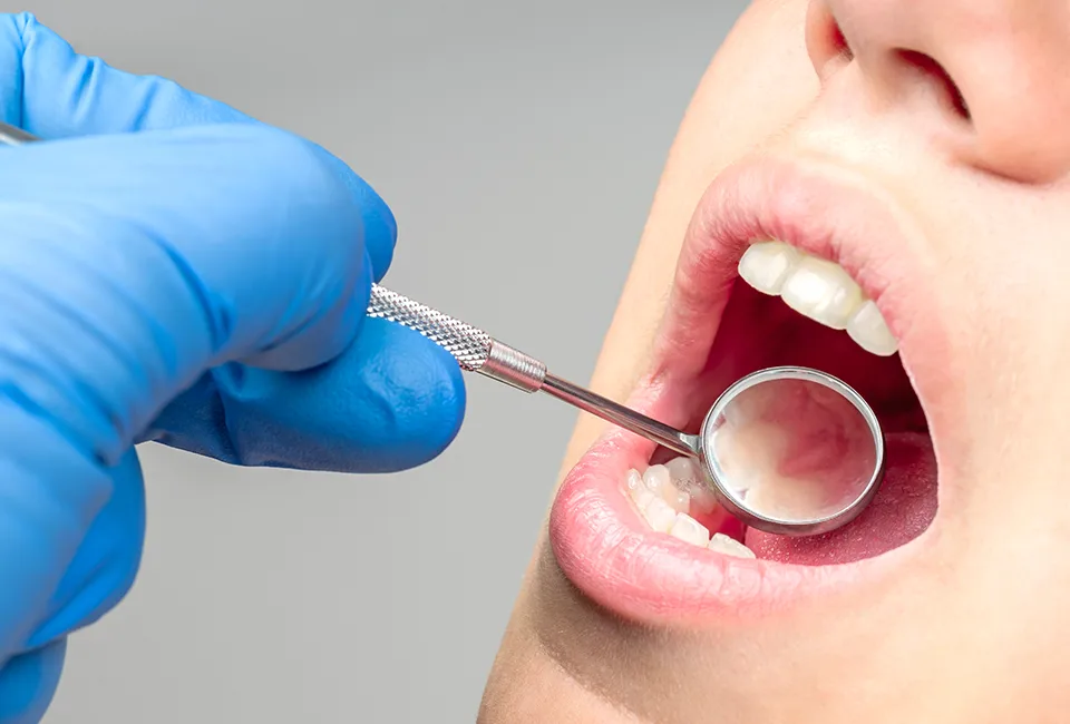 Dental Check